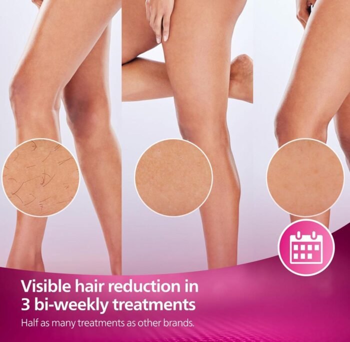 ⁦جهاز Philips Lumea IPL 7000 Series⁩ - الصورة ⁦9⁩